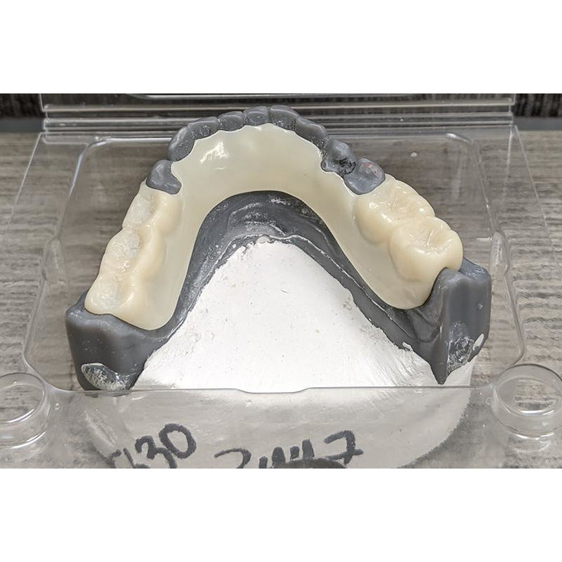 Acetal Frame with Model (Mandible) ROE Dental Laboratory