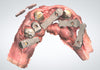 ArchBridge™ IOS Package - Scan Bodies, Screws & Driver