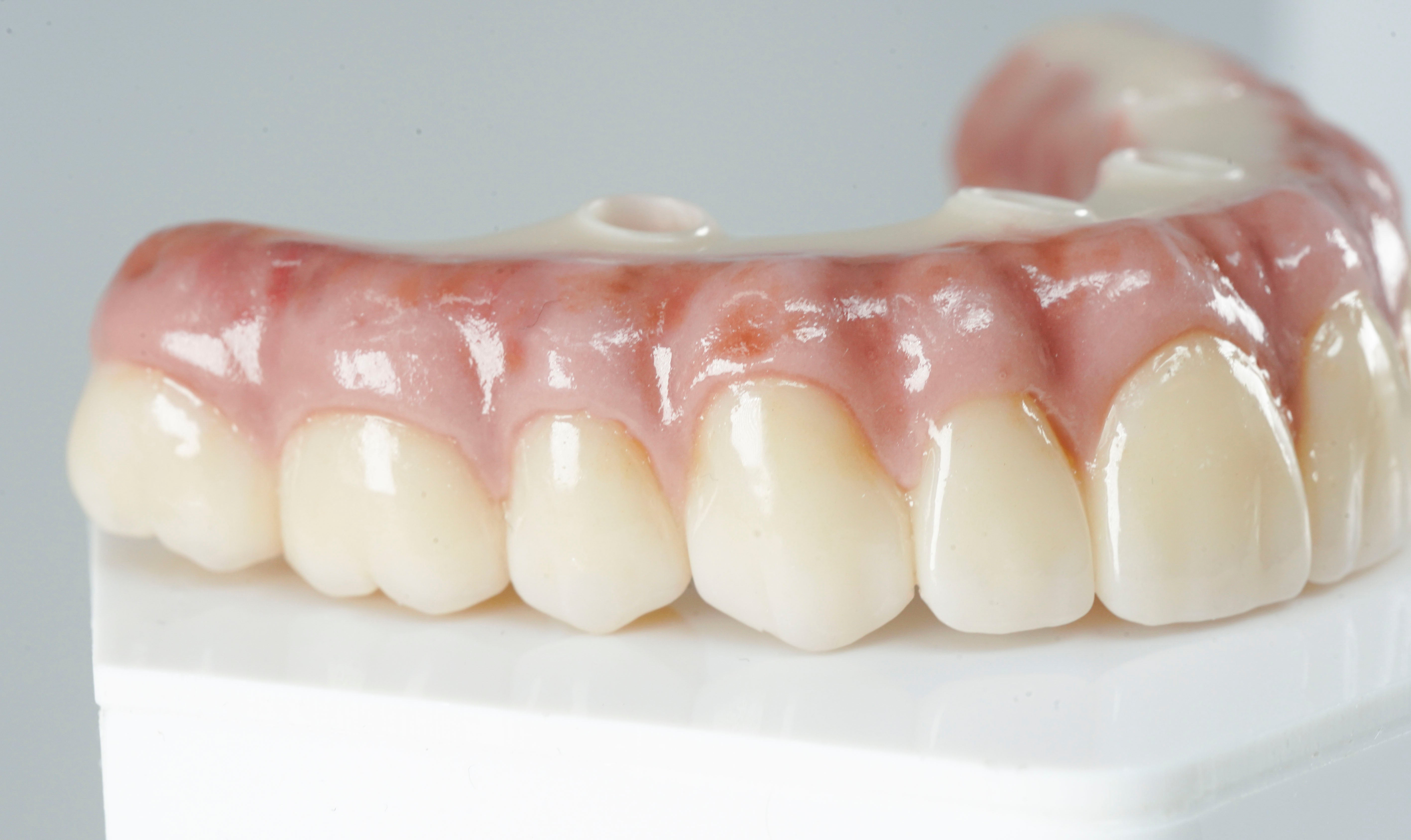 Sample 5– ROE Dental Laboratory