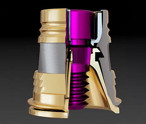 Passivity Plus Copings (5-Pack)