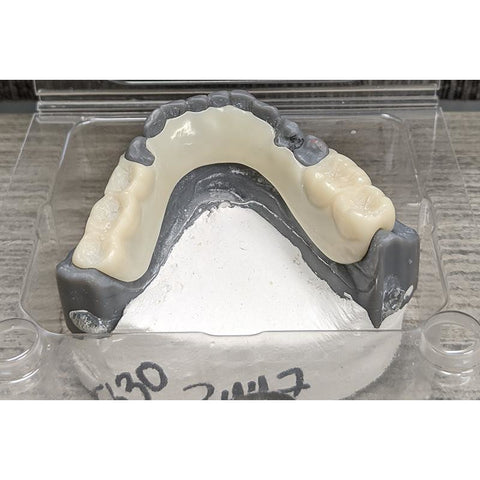 Acetal Frame with Model (Mandible)