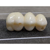 TLZ-SR Bridge without Abutments