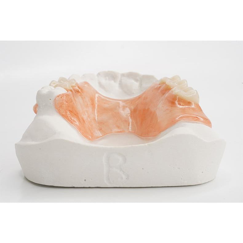Valplast Partial (Upper) ROE Dental Laboratory