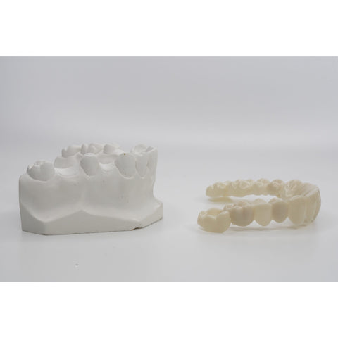 Snap-On Smile Partial