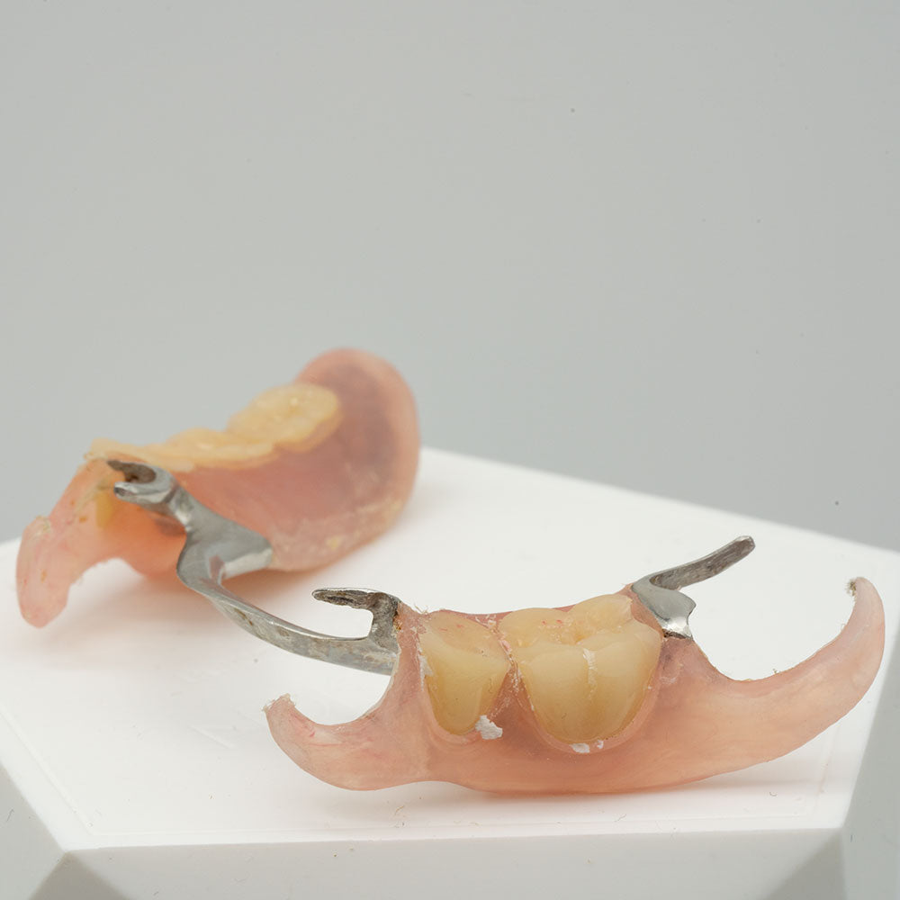 Valplast Partial Hybrid (Maxilla)– ROE Dental Laboratory